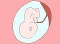 【康代宝试管助孕】没有输卵管的女性也能做试管婴儿生育吗？