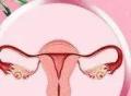 有多囊卵巢怎样快速怀孕