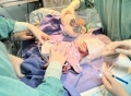 三次环扎延长孕周 上海市东方医院为“特殊妈妈”迎来27周超早产宝宝
