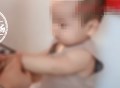银针试毒？1岁宝宝手上银镯变色，送医后意外发现是中毒