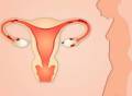 胚胎都被宫腔积液冲走了，还怎么怀孕？36岁姐妹好孕经验告诉你