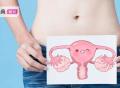 子宫肌瘤是“吃”出来的吗？你想知道的都在这里