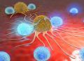《自然评论·癌症》：自然杀伤细胞——细胞免疫疗法的下一个“引爆点”！