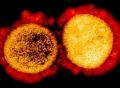 《自然》发表重要研究成果：冠状病毒能用宿主天然免疫屏障促进自身有效复制