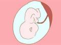 【康代宝试管中心】输卵管疏通术后还是无法怀孕，可以做试管婴儿吗？
