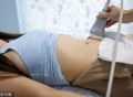 子宫内膜异位症可以做试管婴儿吗？