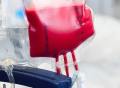 Nature子刊：“换血大法”治疗阿尔茨海默病具有可行性！