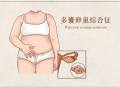 云南中西医结合医院｜多囊卵巢综合征不可怕，一半的多囊患者可自然受孕