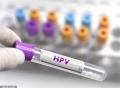 疫苗焦虑与被神化的九价HPV疫苗
