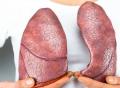 《细胞发现》：广州医科大学团队发现肺癌新靶点！