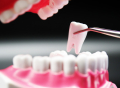 牙体治疗费用会纳入医保吗？一口好牙不该成为奢侈品