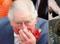 73岁英国国王手指肿胀如腊肠，健康状况明显堪忧，有哪些病可能导致手肿？