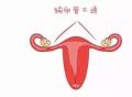兰州天伦医院科普：备孕女性出现输卵管不通会有什么危害？