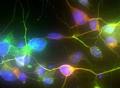 皮肤细胞成功转化为神经元！这对神经元丧失的帕金森病患者意味着什么？